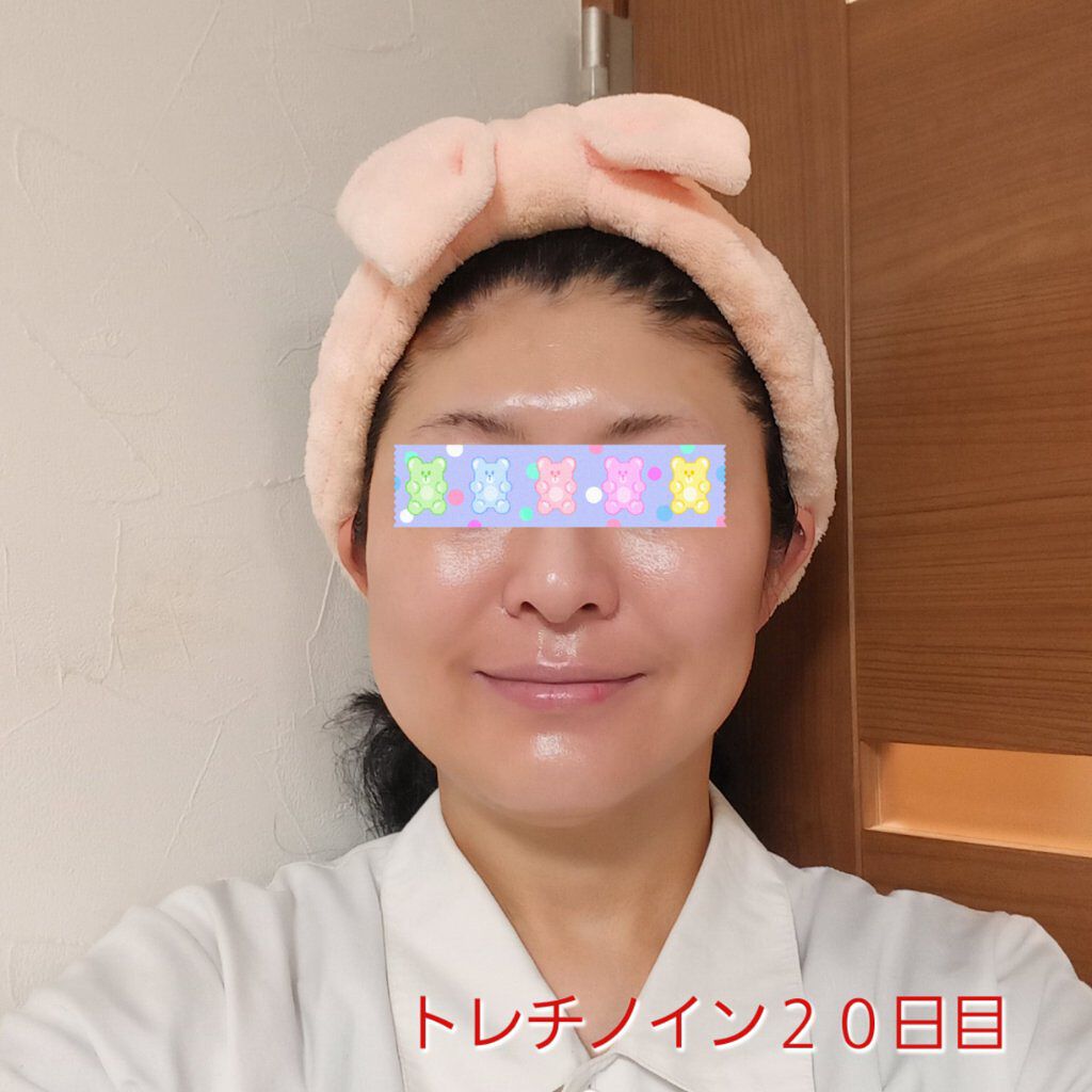 リンクルシートマスク Ｎ/なめらか本舗/シートマスク・パックを使ったクチコミ（1枚目）