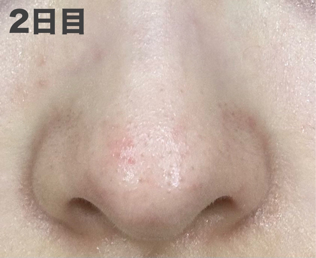 おうちdeエステ 肌をなめらかにするマッサージ洗顔ジェル 炭/ビオレ/その他洗顔料を使ったクチコミ(6枚目)