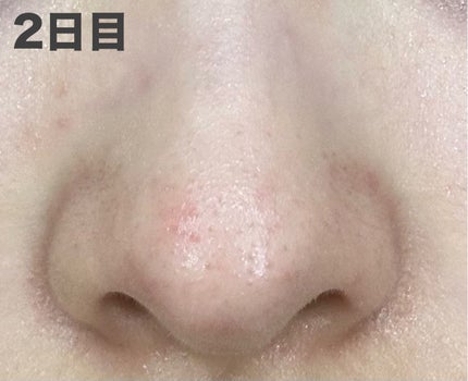 おうちdeエステ 肌をなめらかにするマッサージ洗顔ジェル 炭/ビオレ/その他洗顔料を使ったクチコミ(6枚目)