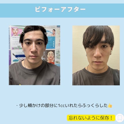 じゅん on LIPS 「".@jun_mens_biyou←他の美容投稿もチェック!!..」(6枚目)