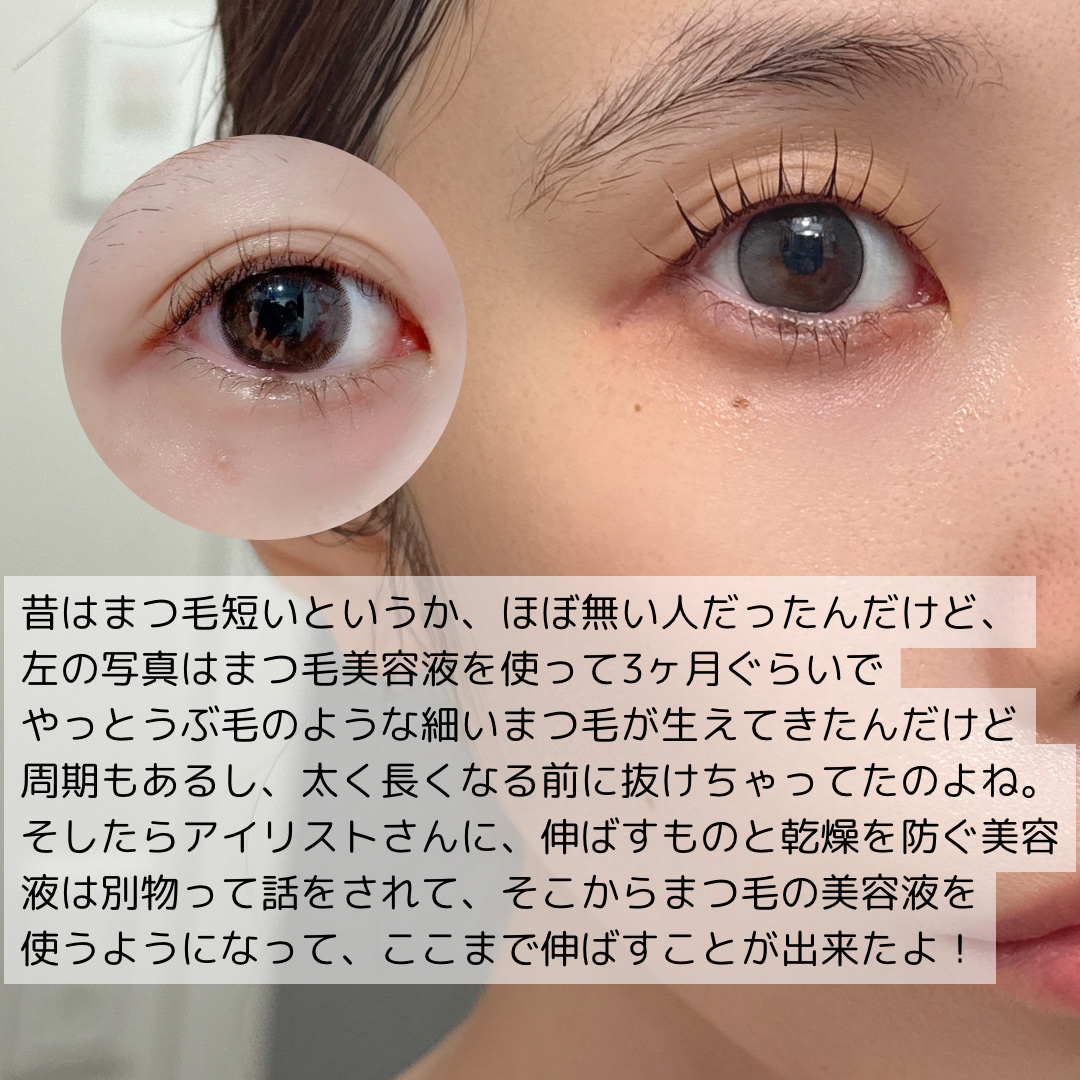 MABAYUKI/MABAYUKI/まつげ美容液を使ったクチコミ（2枚目）