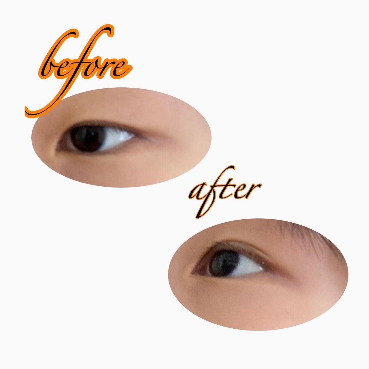 ブラックファイバー120 スーパーハードタイプ 120本入/メザイク/二重まぶた用アイテムを使ったクチコミ(3枚目)