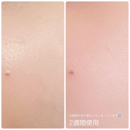 シカレチA エッセンス0.1/VT/美容液を使ったクチコミ(8枚目)