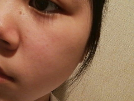 ハトムギ化粧水(ナチュリエ スキンコンディショナー R )/ナチュリエ/化粧水を使ったクチコミ(2枚目)