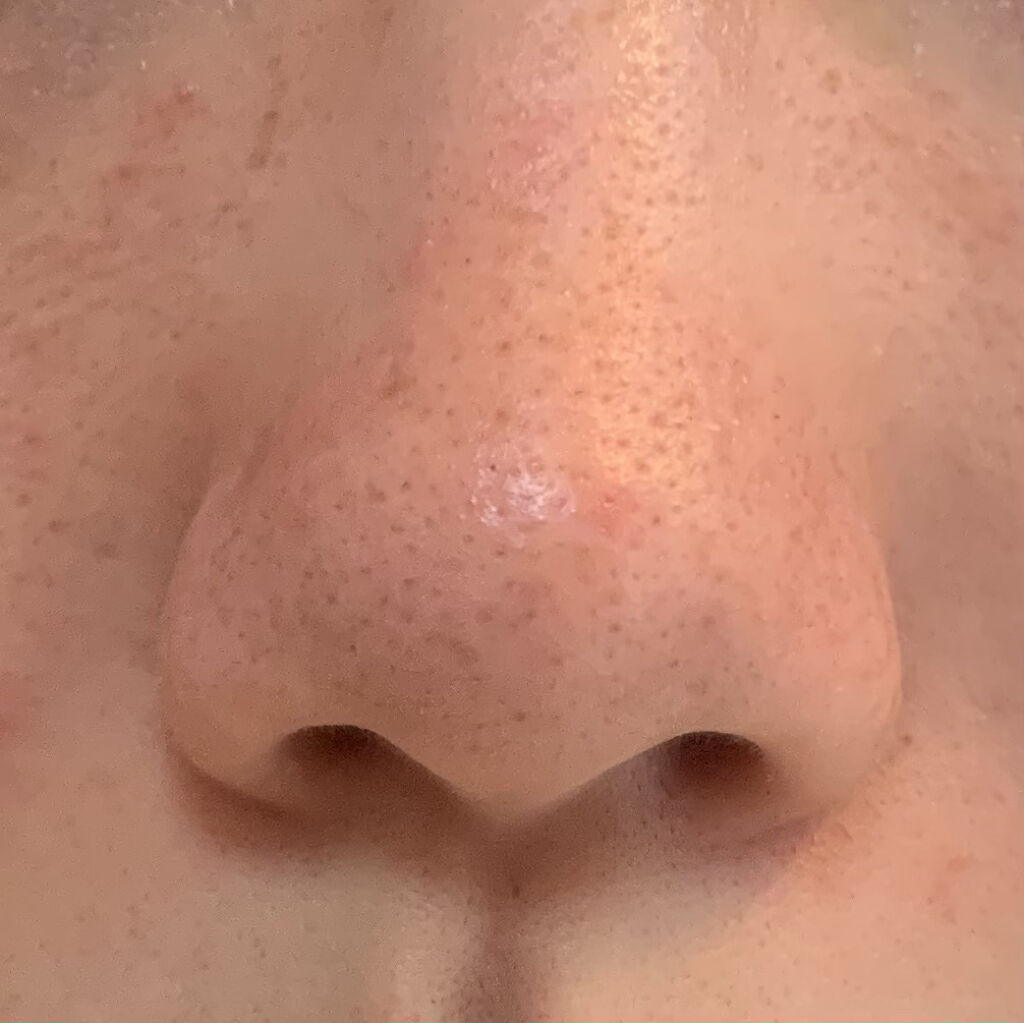 炭・鼻の毛穴ジェルパック/DAISO/シートマスク・パックを使ったクチコミ（3枚目）