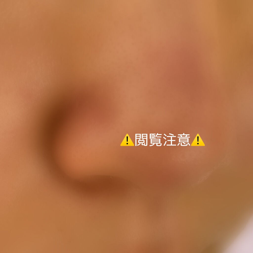 薬用クリーム洗顔/メンソレータム アクネス/洗顔フォームを使ったクチコミ(1枚目)