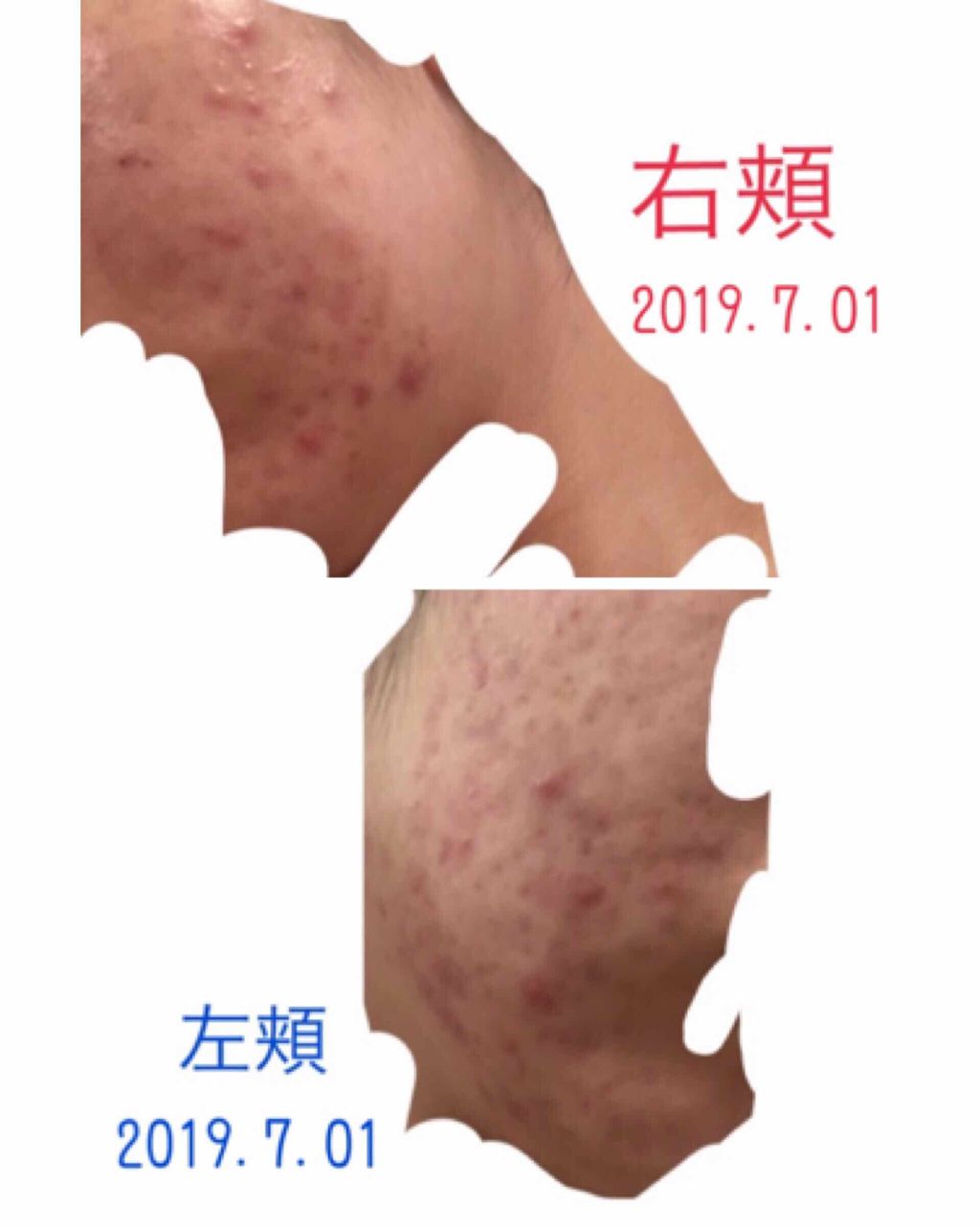 ソフティモ 薬用ホワイト クレンジングウォッシュ/ソフティモ/洗顔フォームを使ったクチコミ（2枚目）