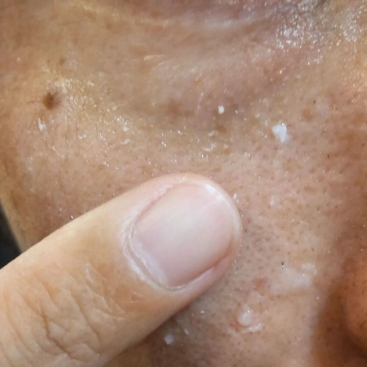 ピールショット/北の快適工房/ピーリングを使ったクチコミ(4枚目)