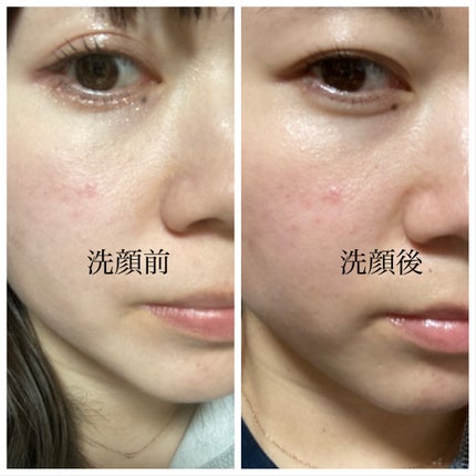 BALM CLEANSE メルティブラック/MELLIFE/クレンジングバームを使ったクチコミ(2枚目)