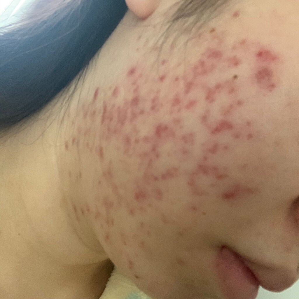 美容原液 オパール R-III/薬用 オパールR-Ⅲ/美容液を使ったクチコミ(3枚目)