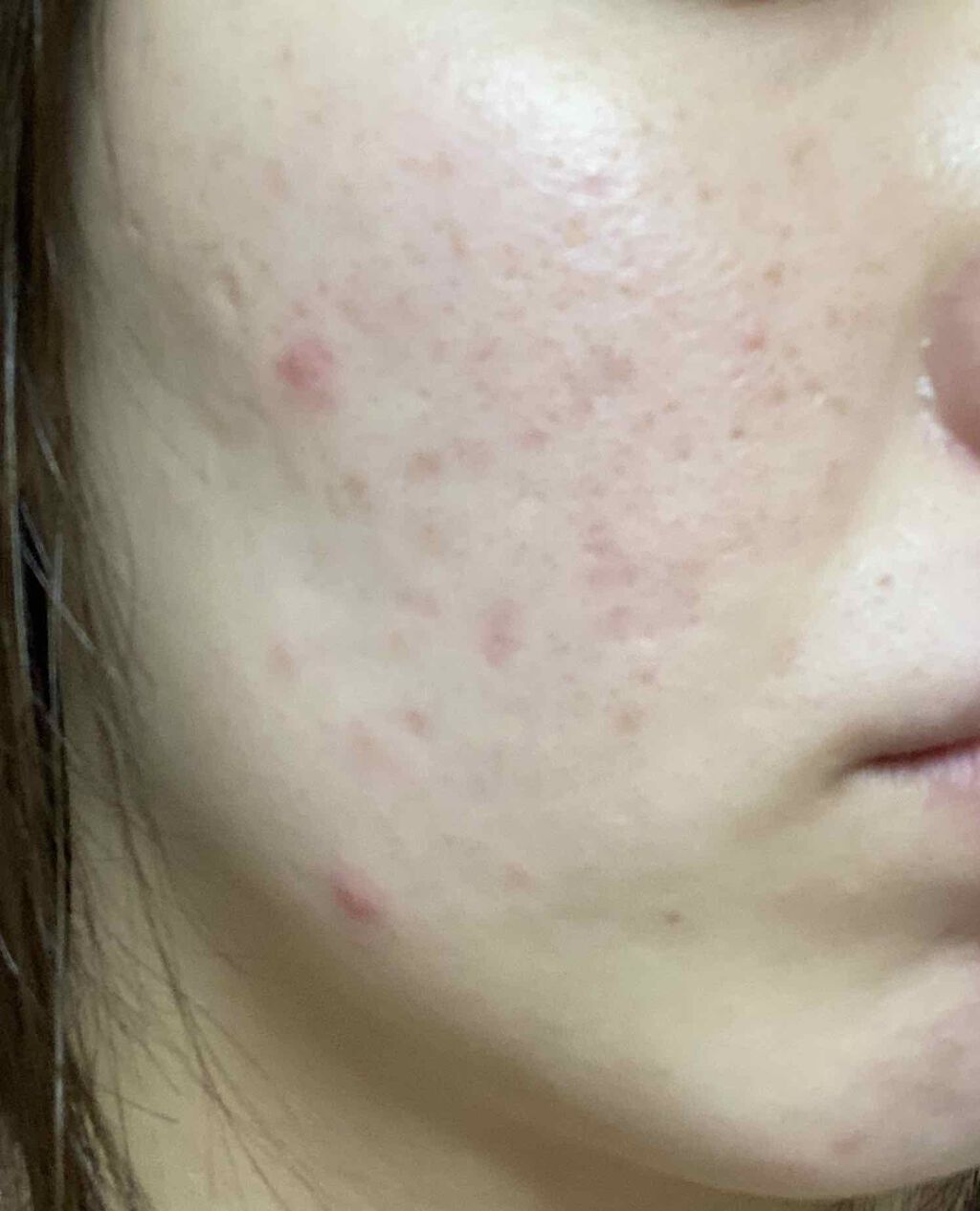 ザ・タイムR アクア/IPSA/化粧水を使ったクチコミ（1枚目）