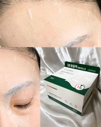 レッドブレミッシュクイックPHAシートマスク/Dr.G/シートマスク・パックを使ったクチコミ(5枚目)