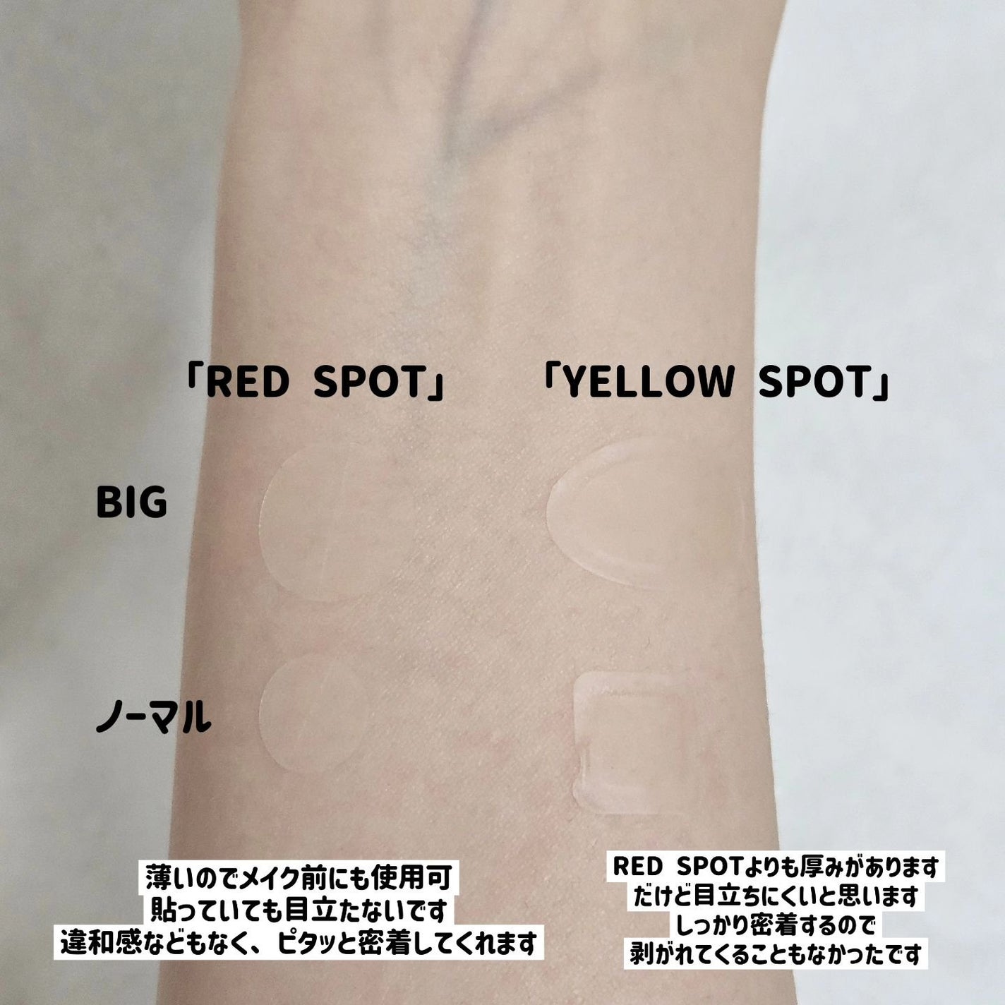 へサリン スポットケア パッチキット/HATHERINE/にきびパッチを使ったクチコミ(5枚目)