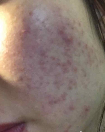 を使ったクチコミ(1枚目)