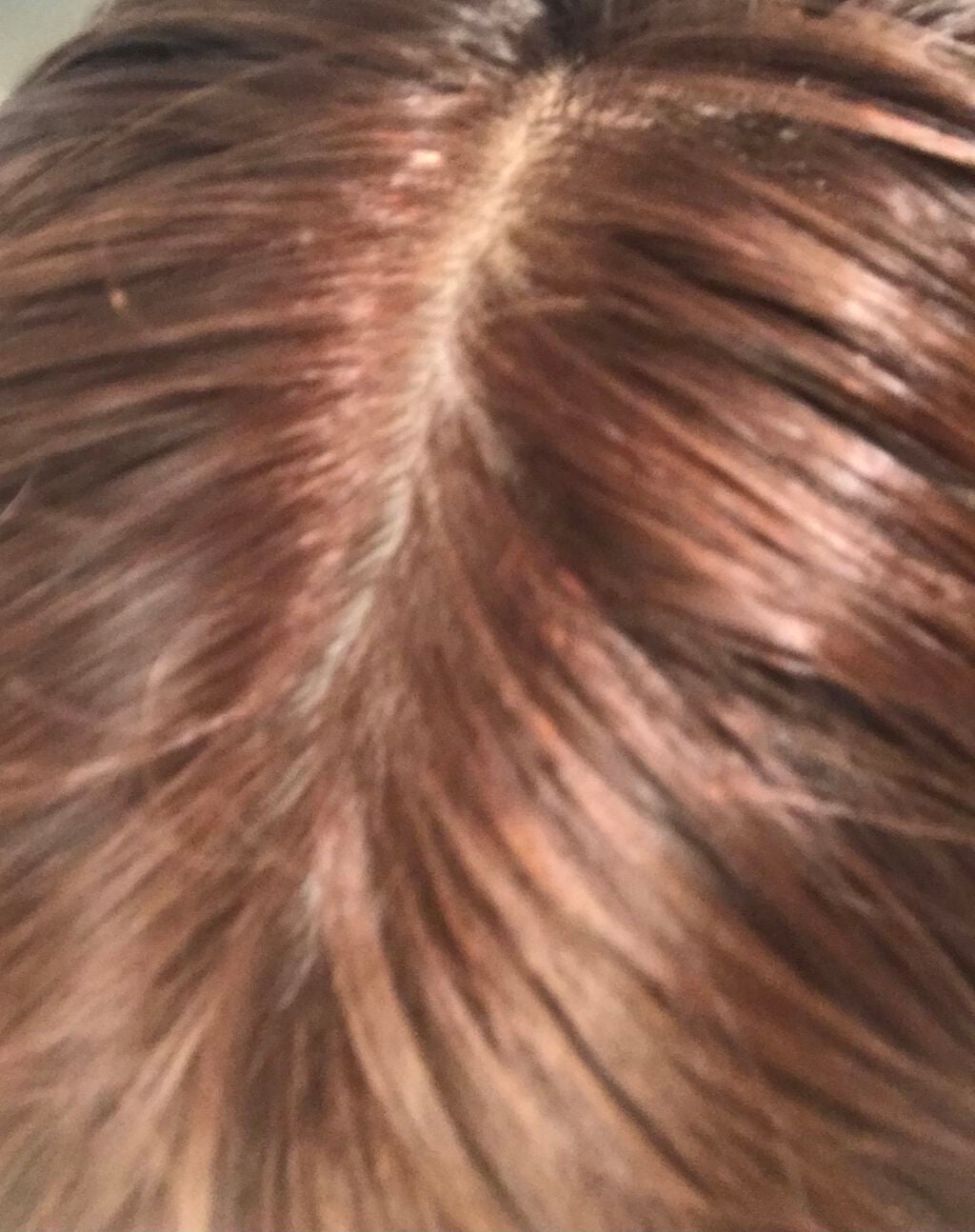 泡カラー/リーゼ/ヘアカラーを使ったクチコミ(1枚目)