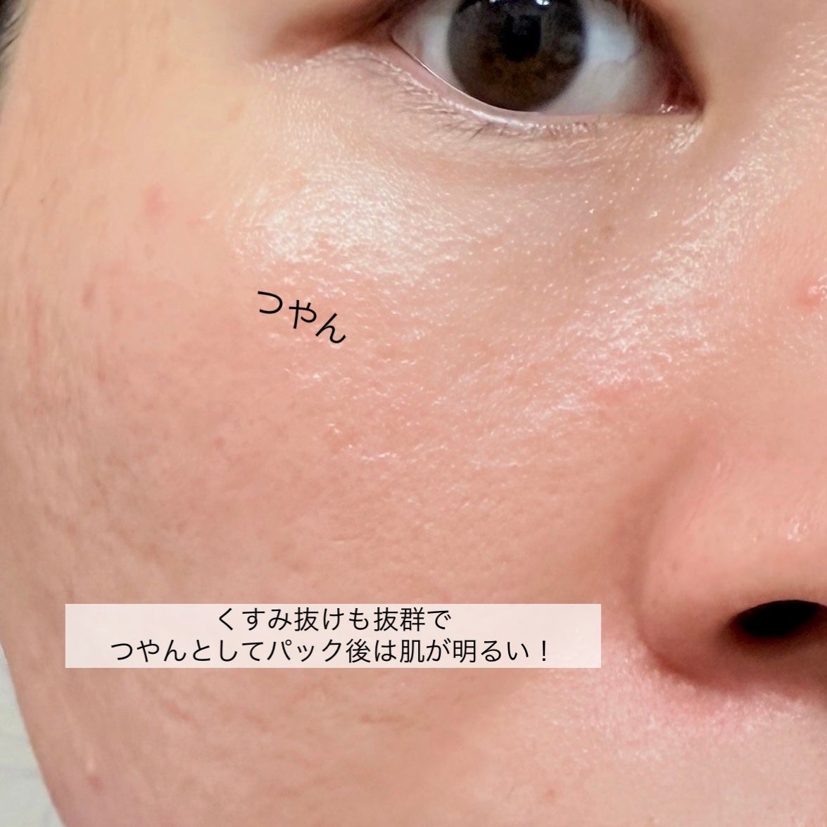 クリアエッセンスマスク/ピュレア/シートマスク・パックを使ったクチコミ(8枚目)