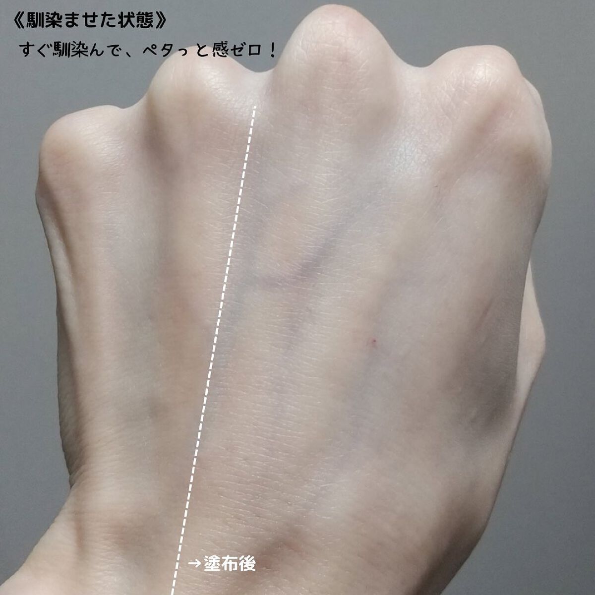シカレチA エッセンス0.1/VT/美容液を使ったクチコミ(9枚目)