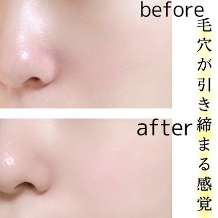 セラムジェル/YELLFOR/美容液を使ったクチコミ(5枚目)