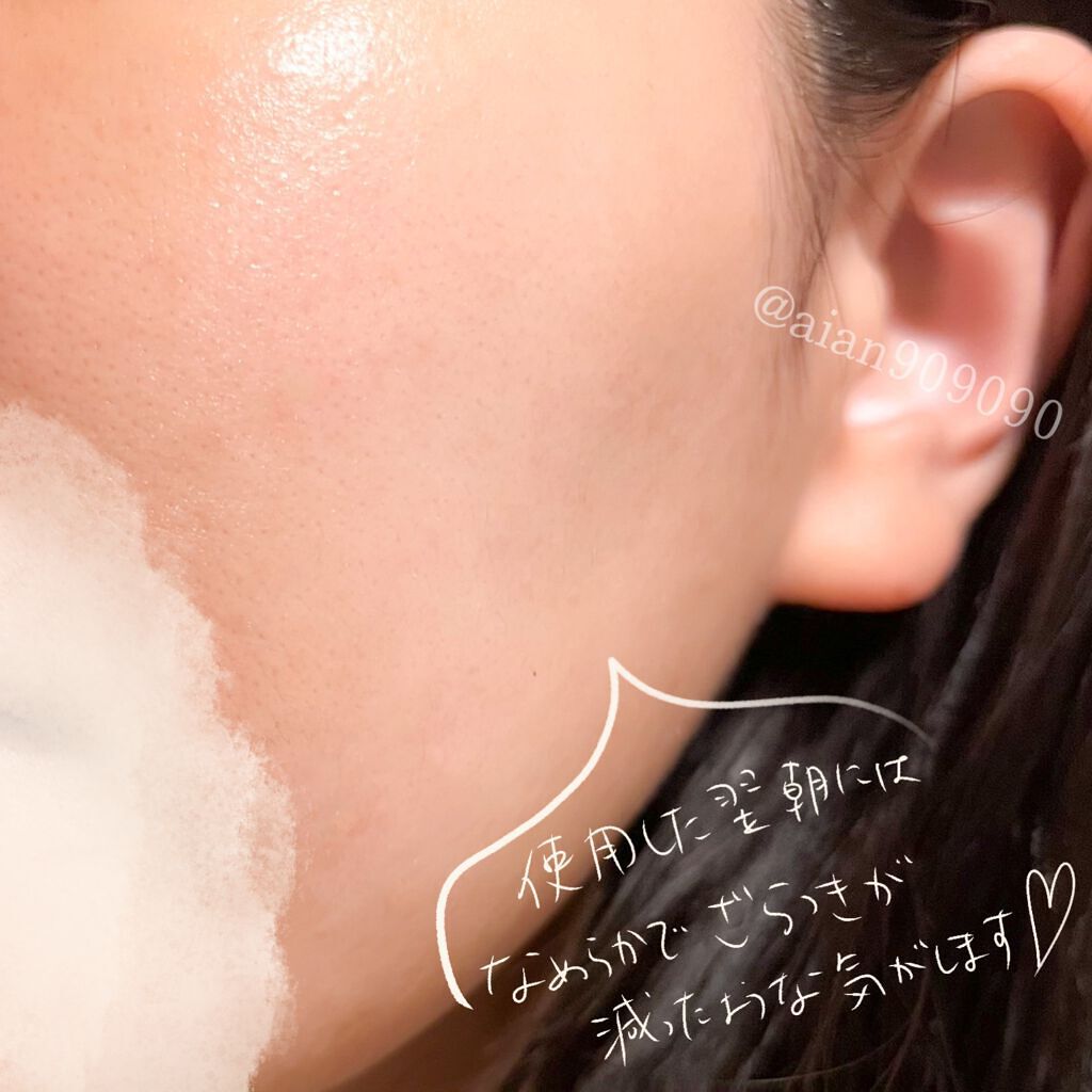 BHA ピーリングアンプル/beplain/美容液を使ったクチコミ(5枚目)