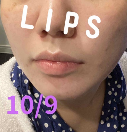 CICA デイリースージングマスク/VT/シートマスク・パックを使ったクチコミ(1枚目)