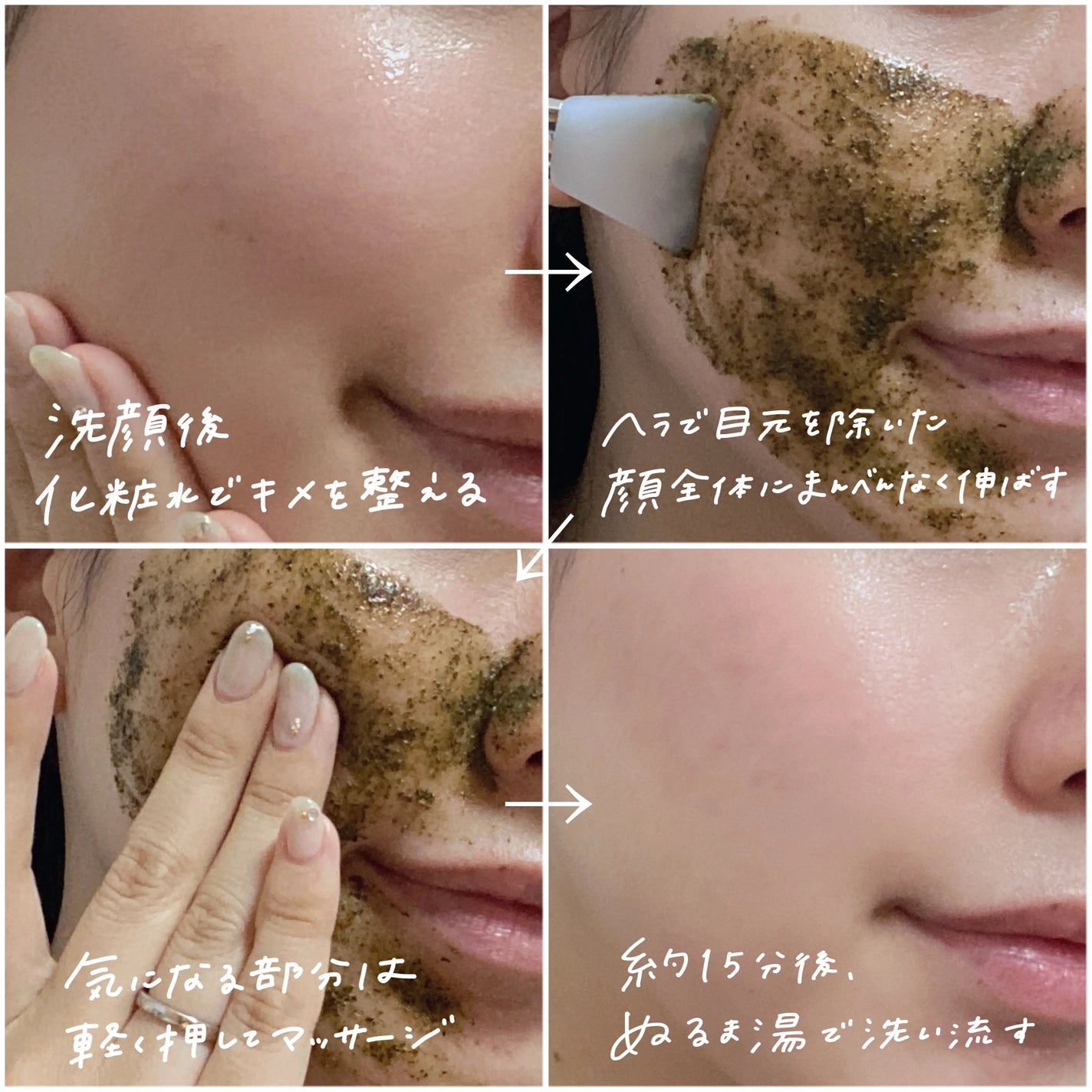 ãã£ãŒããªãŒããŒãããŒãªã³ã°ããã¯/WellDerma/æŽãæµãããã¯ã»ãã¹ã¯ã䜿ã£ãã¯ãã³ãïŒ5æç®ïŒ