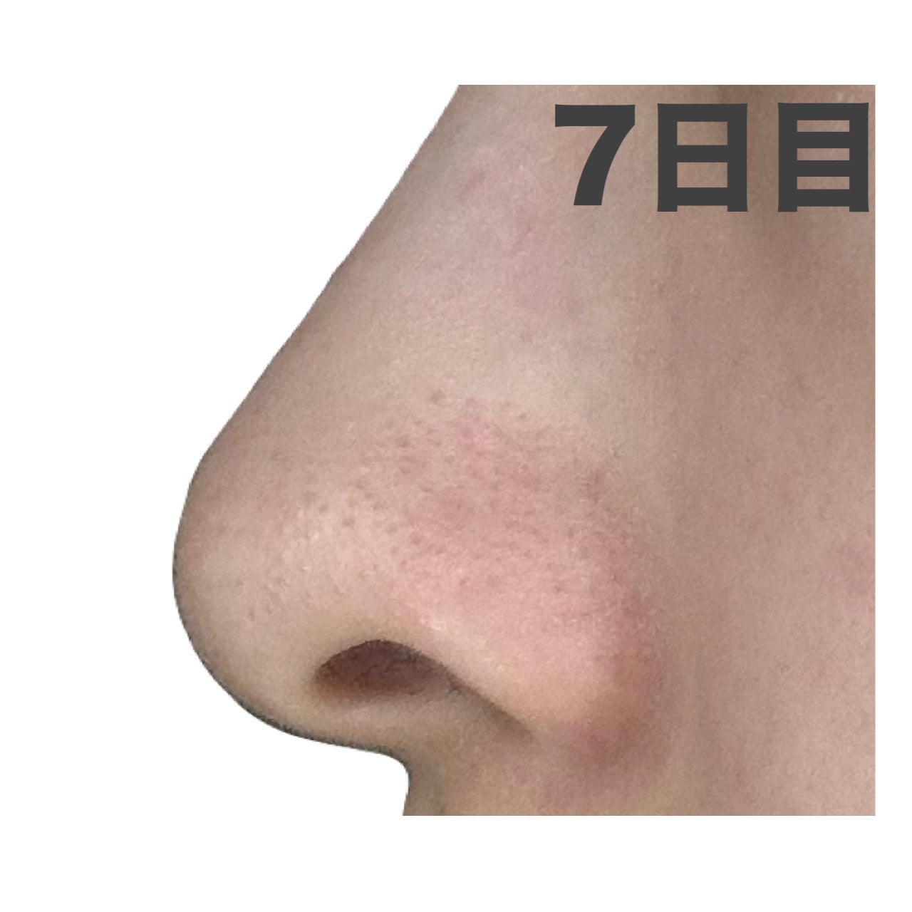 デュオ ザ クレンジングバーム ブラックリペア /DUO/クレンジングバームを使ったクチコミ(5枚目)