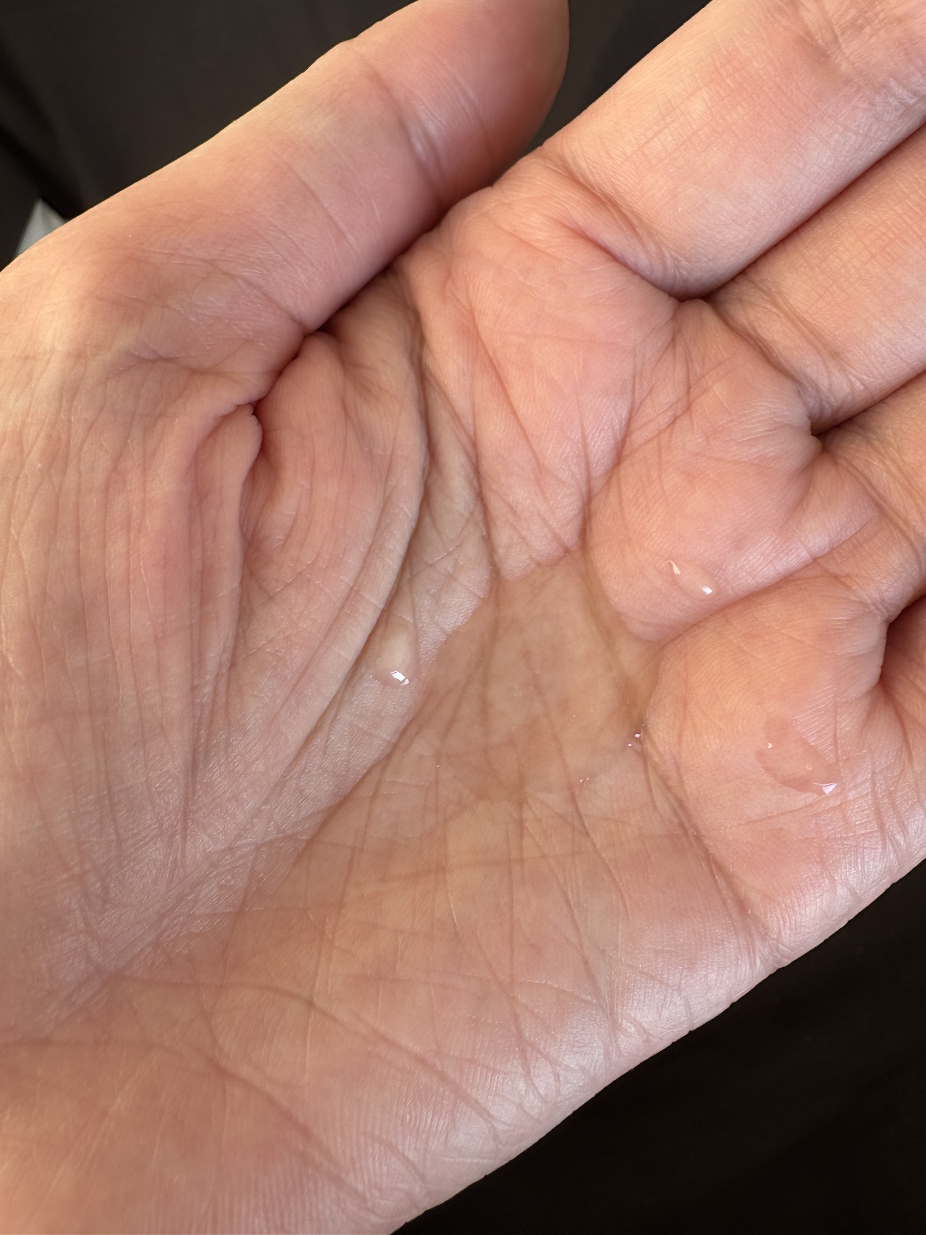 ソーマ ES/ソーマ化粧品/化粧水を使ったクチコミ（2枚目）