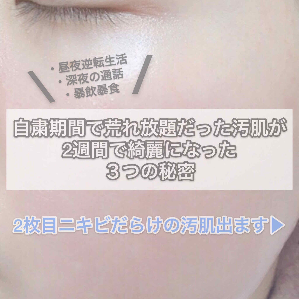 ハトムギ保湿ジェル(ナチュリエ スキンコンディショニングジェル)/ナチュリエ/美容液を使ったクチコミ（1枚目）