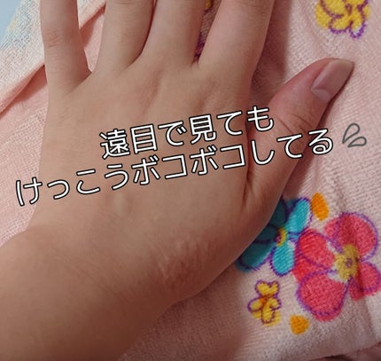 トーンショットクリーム/アバンタイム/フェイスクリームを使ったクチコミ(3枚目)