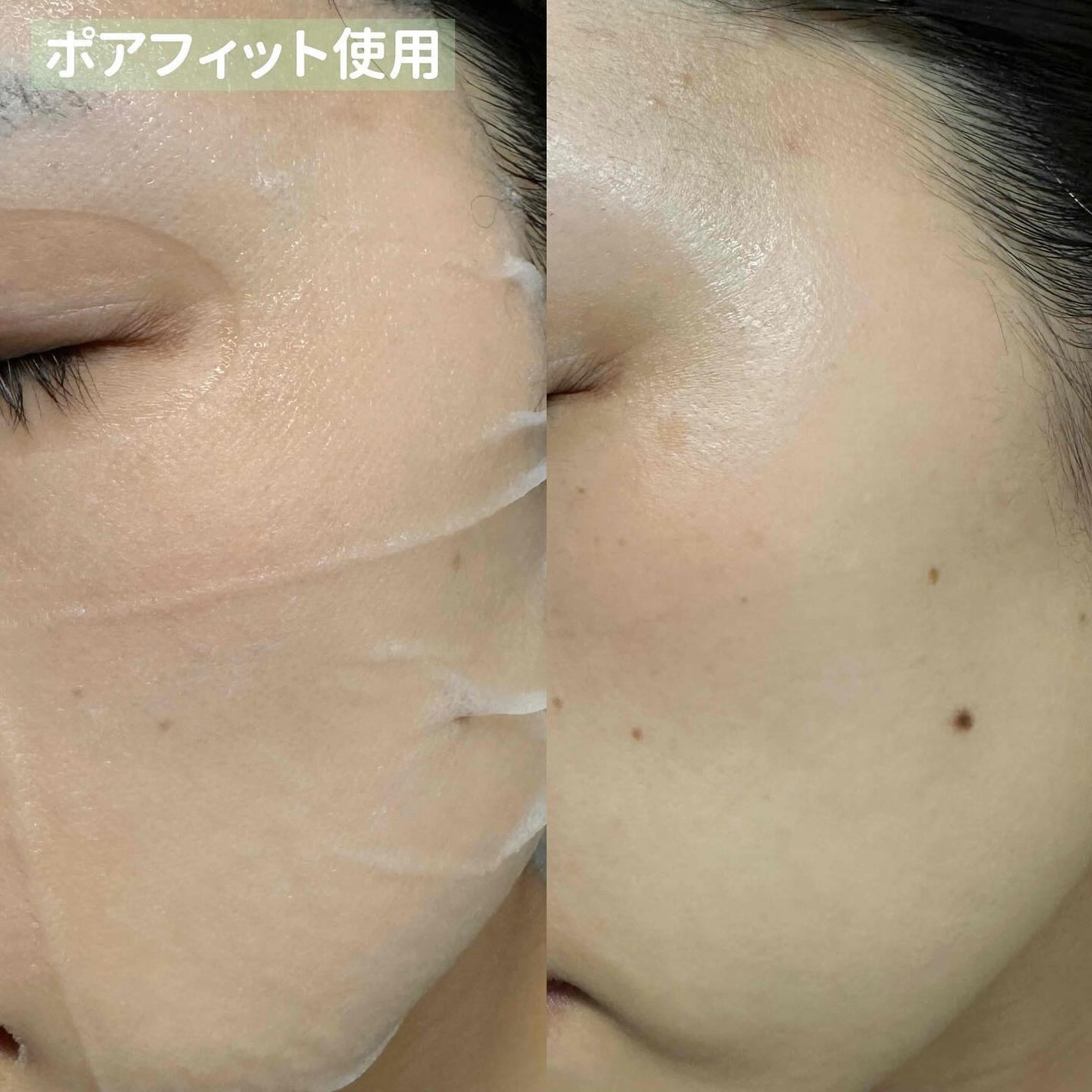 PHセンシティブマスクスージング&モイスト/SAM'U/シートマスク・パックを使ったクチコミ(7枚目)