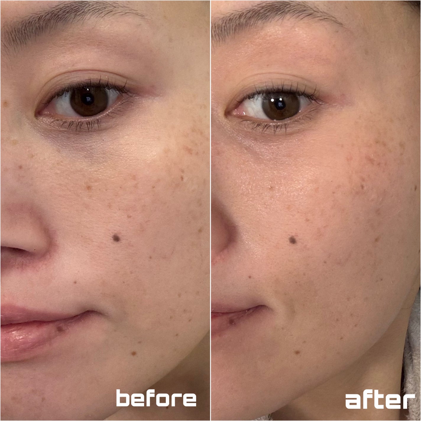 BFTパック/R-FACE/洗い流すパック・マスクを使ったクチコミ(9枚目)