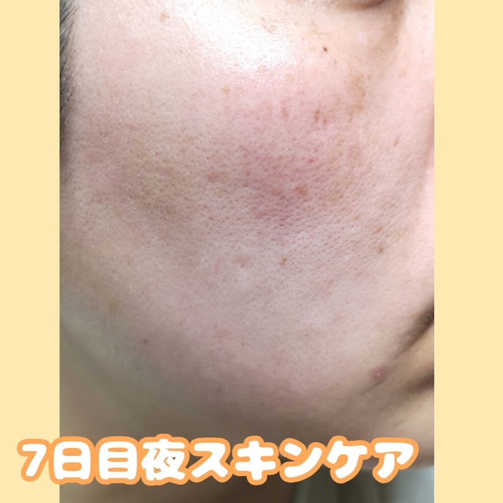 ホワイトニングクリア ローション/d プログラム/化粧水を使ったクチコミ（2枚目）