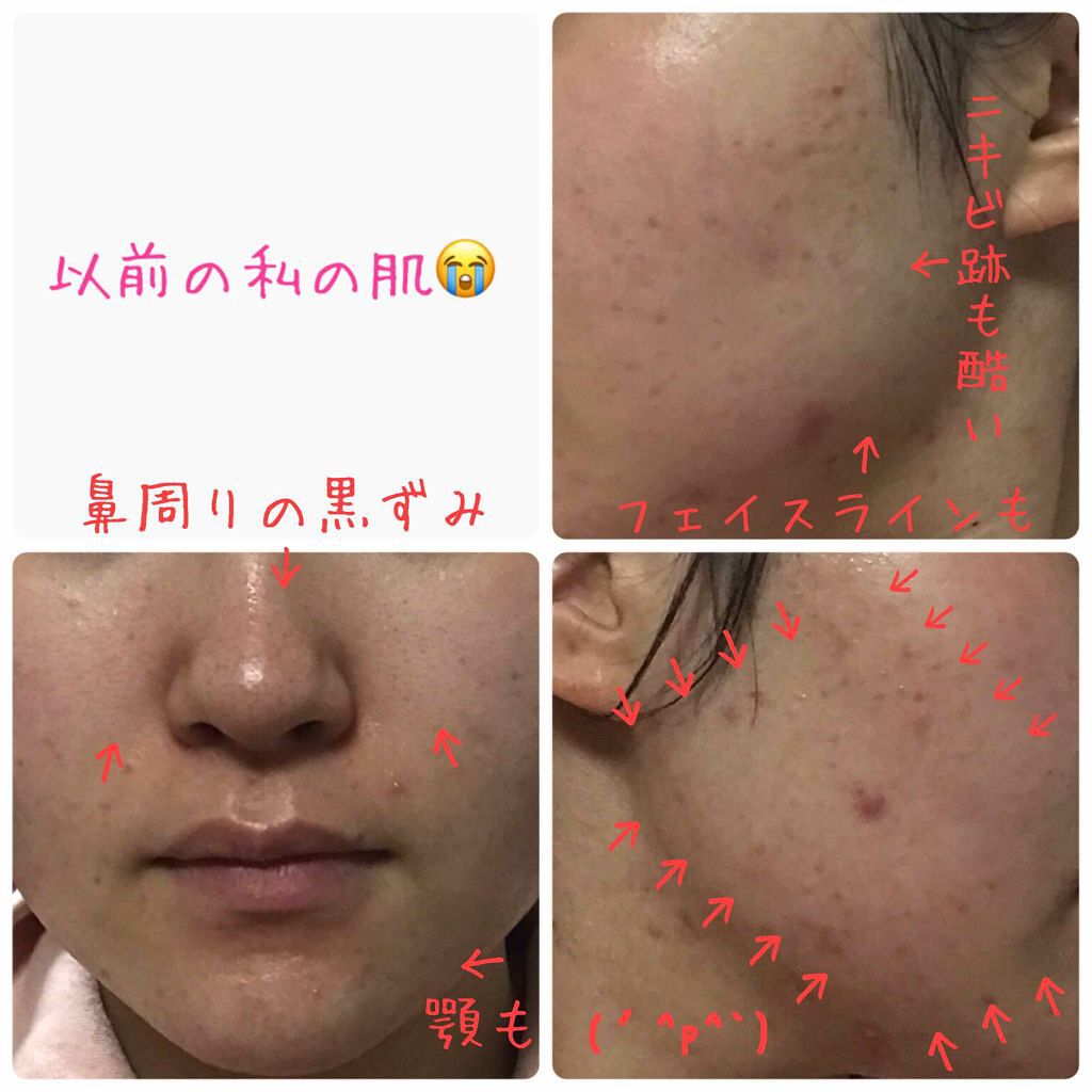 アルビオン 薬用スキンコンディショナー エッセンシャル/ALBION/化粧水を使ったクチコミ(2枚目)