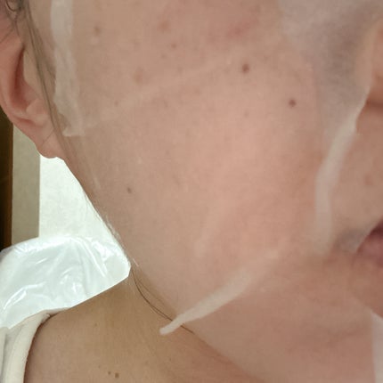 ダーマレーザースーパーVC100マスク/クオリティファースト/シートマスク・パックを使ったクチコミ(3枚目)