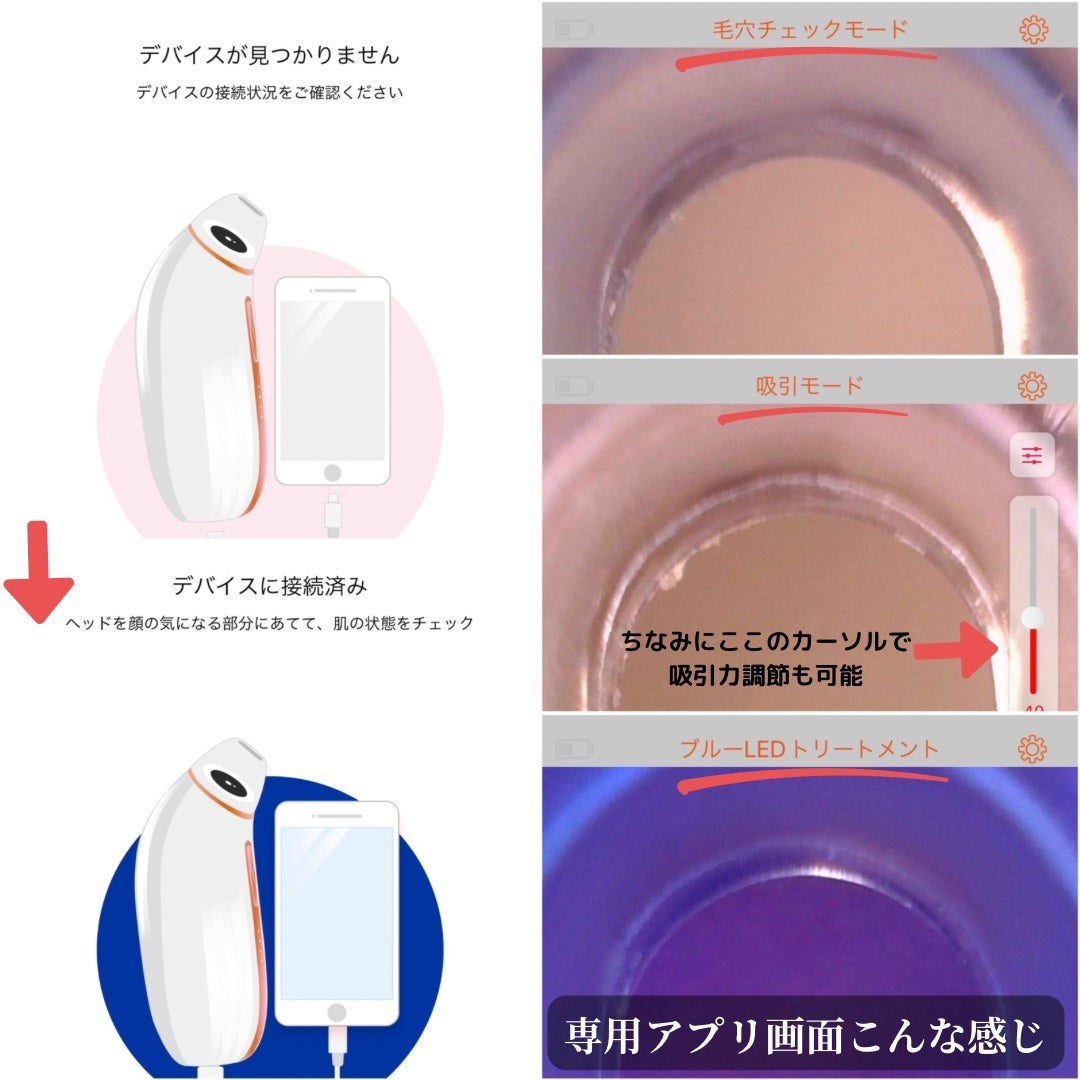 アレティ ポアスコープ/Areti./美顔器・マッサージを使ったクチコミ(10枚目)