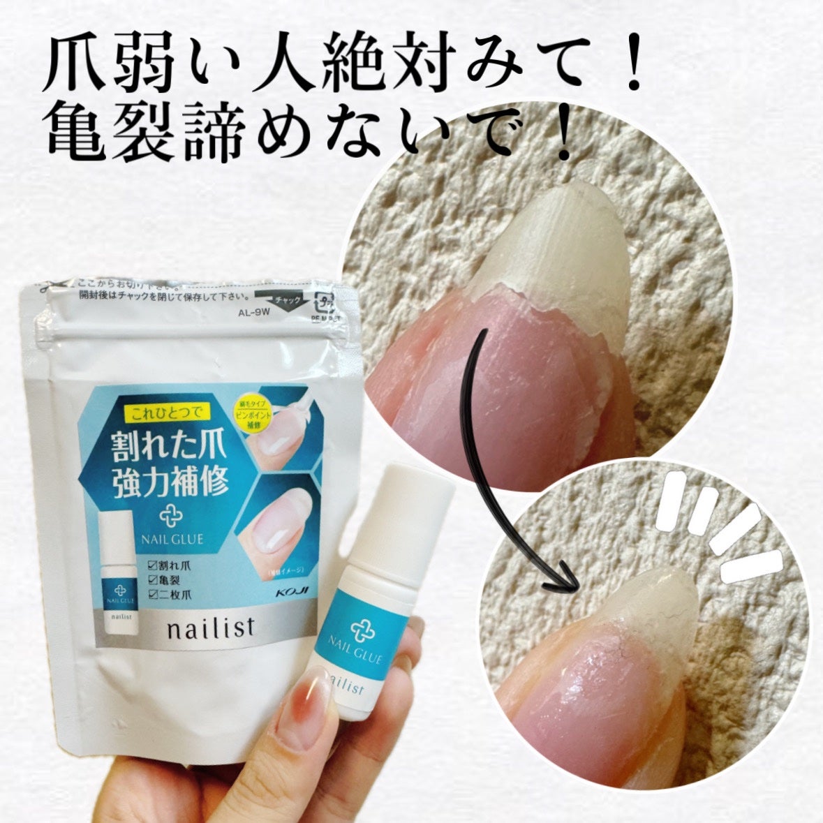 コージー ネイリスト 割れ爪補修グルー/ネイリスト/ネイルオイル・トリートメントを使ったクチコミ(1枚目)