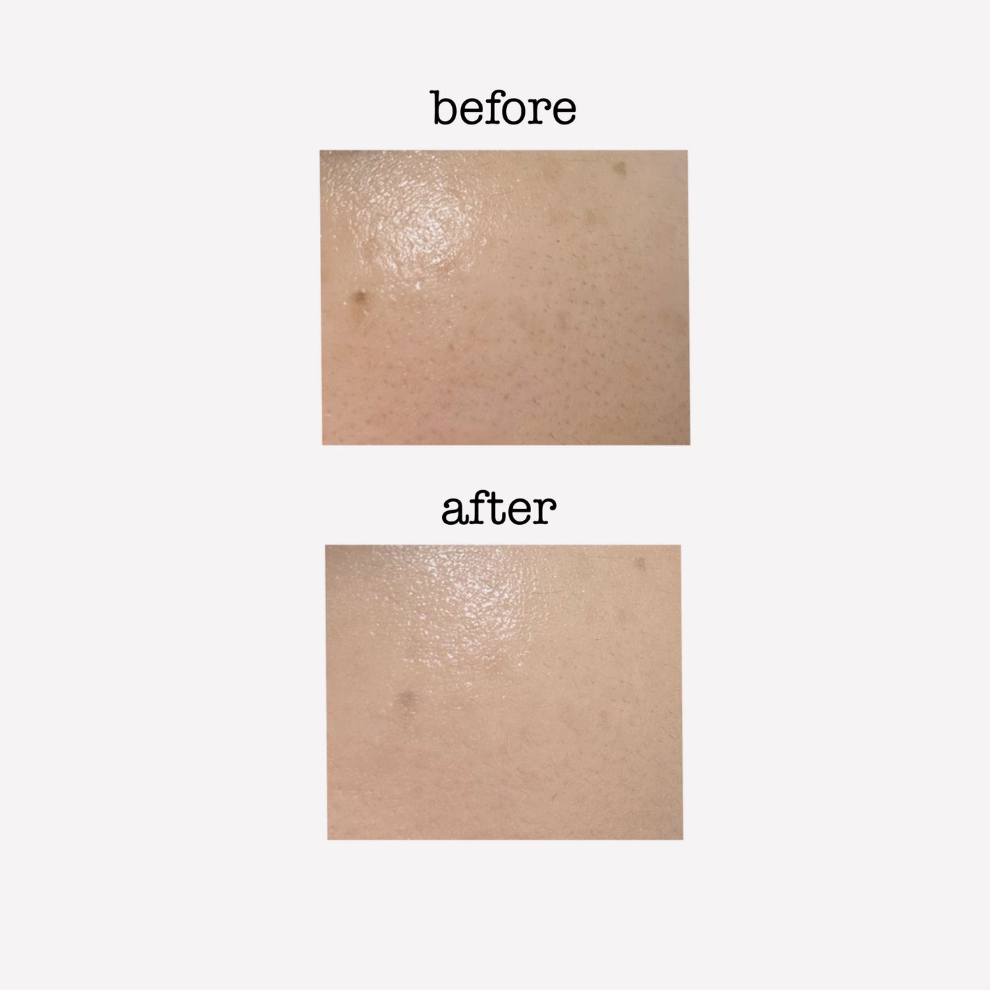 エスト フローレス コンシーリング クリームファンデーション/est/クリーム・エマルジョンファンデーションを使ったクチコミ(2枚目)