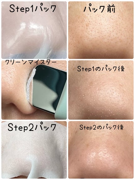 ナチュラルマイルドクリアノーズパック/ilso/シートマスク・パックを使ったクチコミ(5枚目)