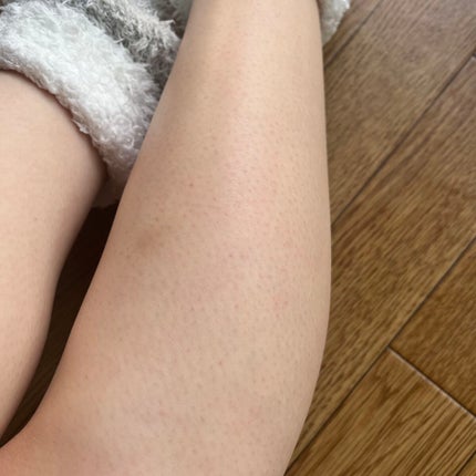 サファイア冷却 脱毛器 ムダ毛ケア/Sarlisi/家庭用脱毛器を使ったクチコミ(7枚目)