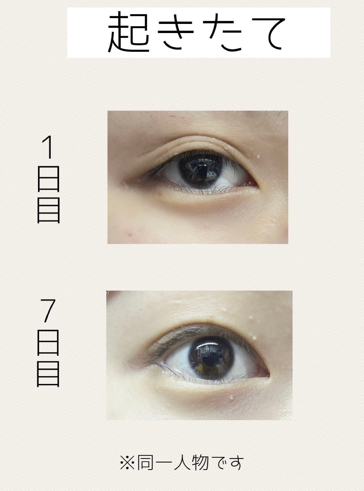 ナイトアイボーテ/StreeTrend/二重まぶた用アイテムを使ったクチコミ(2枚目)