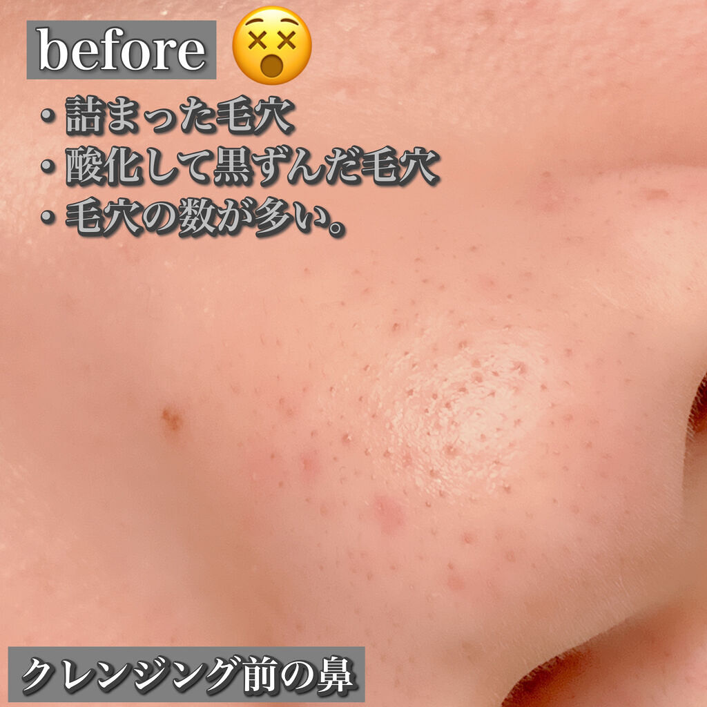 クレンジングバーム ブラック/CLAYGE/クレンジングバームを使ったクチコミ（2枚目）