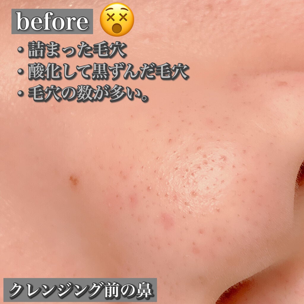 クレンジングバーム ブラック/CLAYGE/クレンジングバームを使ったクチコミ(2枚目)