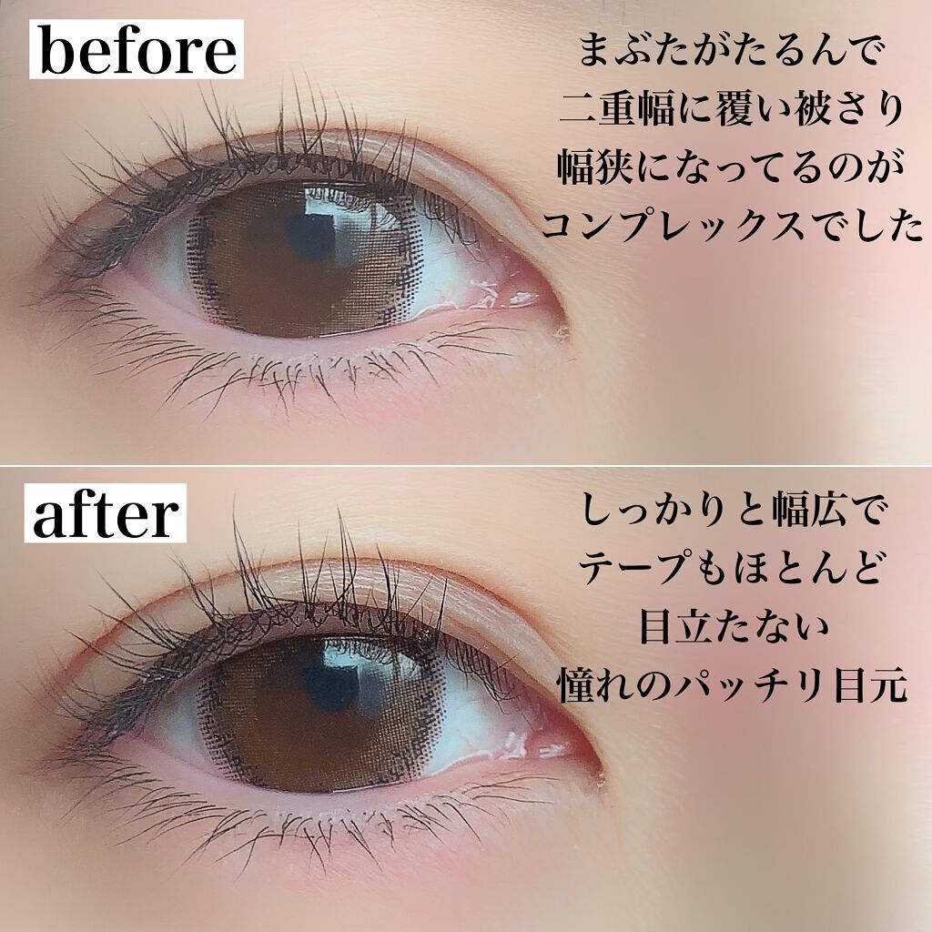 ふたえメッシュテープ/Eye Catching Beauty/二重まぶた用アイテムを使ったクチコミ(6枚目)