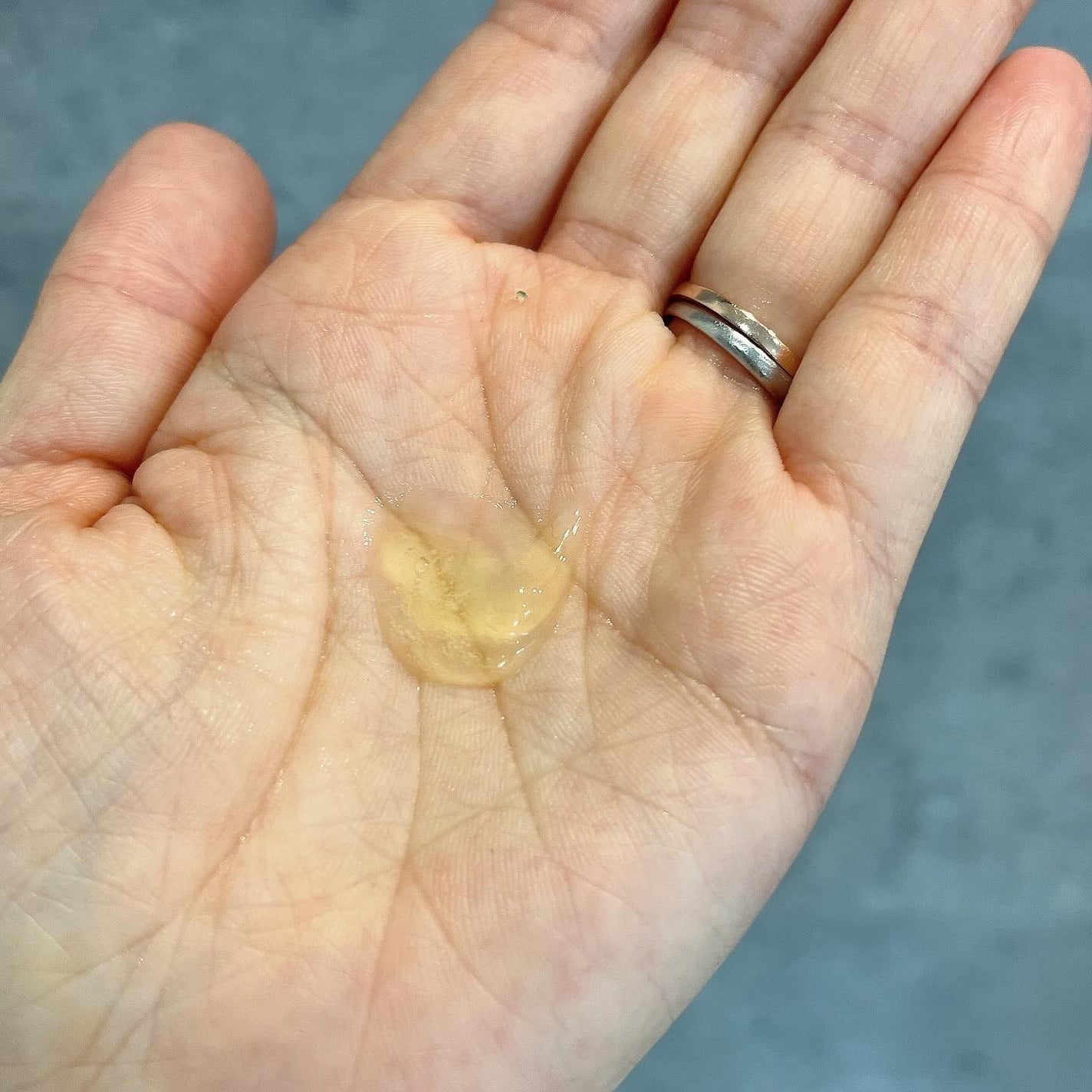 レチノールトナー/APLIN/ミスト状化粧水を使ったクチコミ(6枚目)