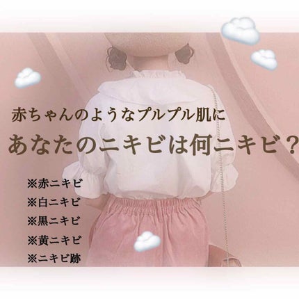 ロゼット洗顔パスタ アクネクリア/ロゼット/洗顔フォームを使ったクチコミ(1枚目)