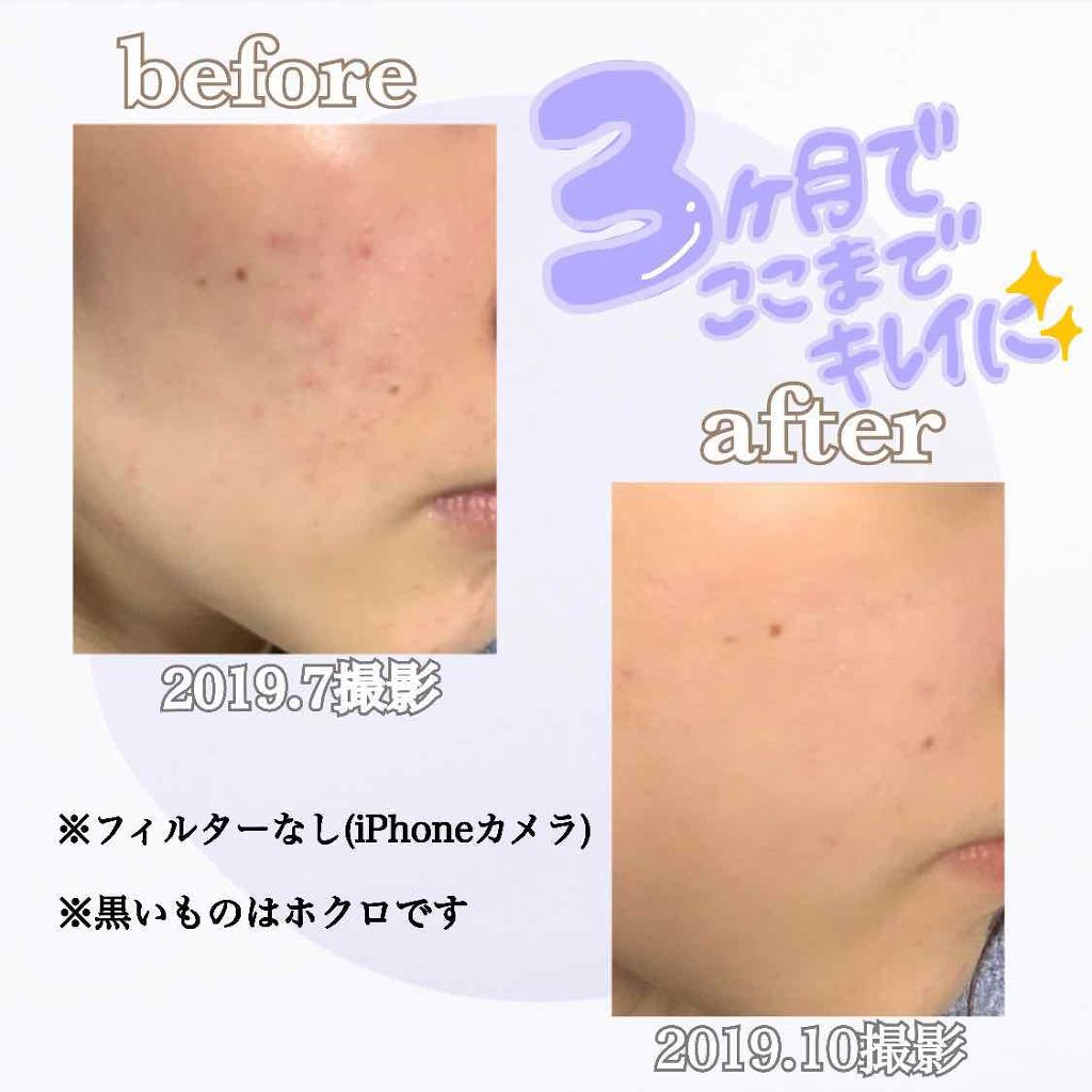 ピーリングソープ/セルニュープラス/洗顔石鹸を使ったクチコミ(2枚目)