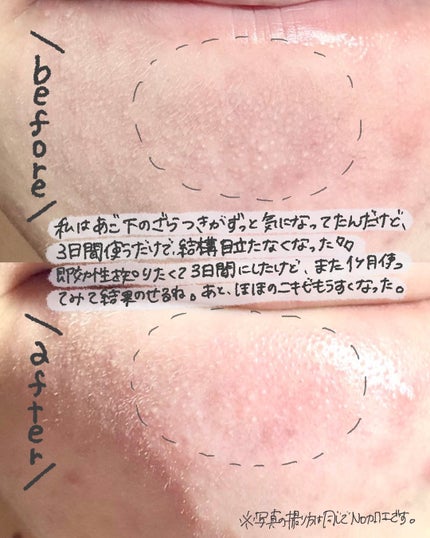 AZケア マスク/VT/シートマスク・パックを使ったクチコミ(4枚目)