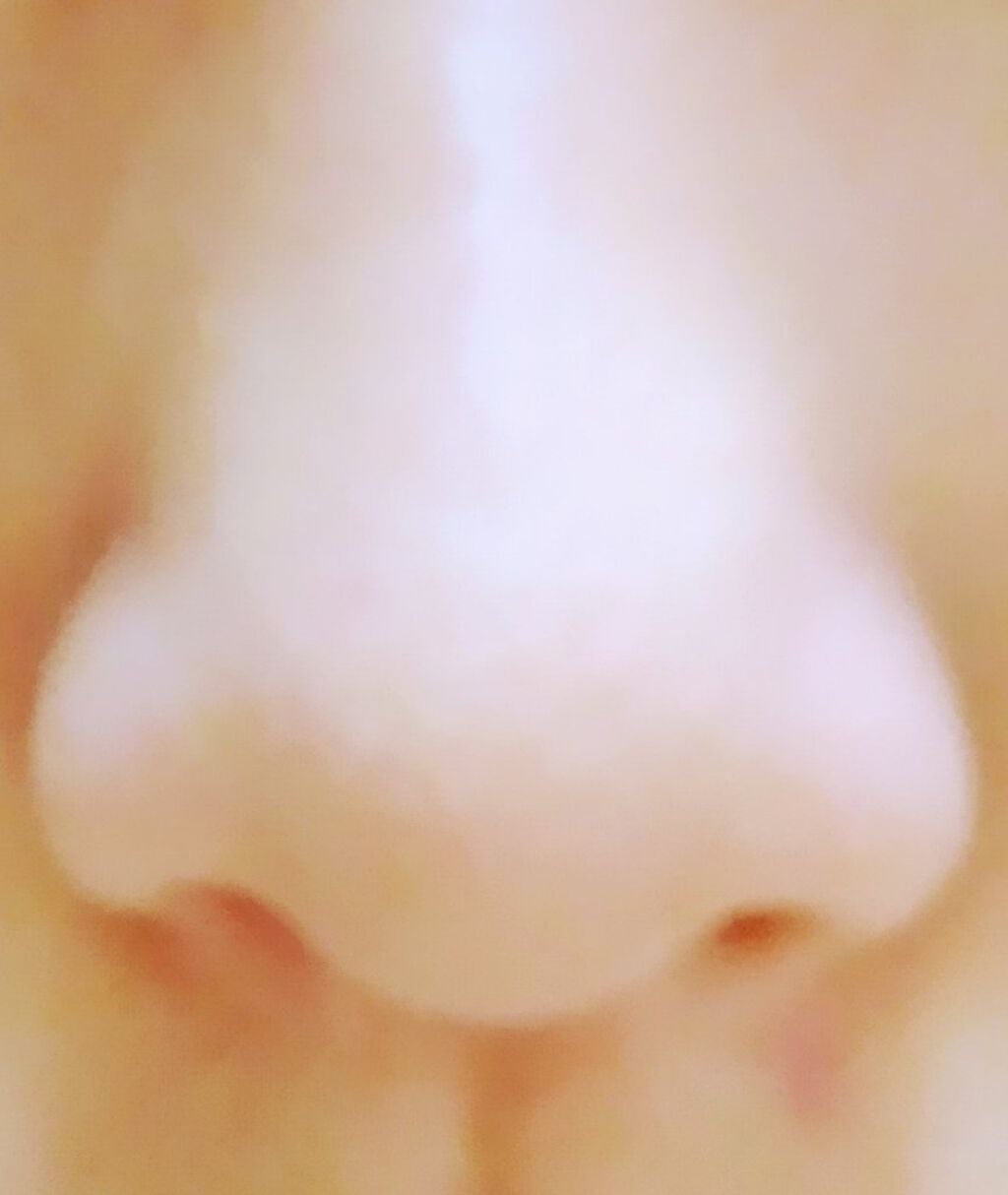 arisu on LIPS 「こんにちわ!arisuです!今回は、🐽鼻だった私が、美鼻になっ..」(3枚目)