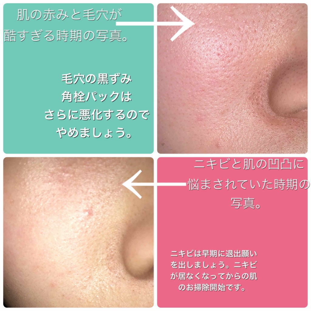 オバジC10セラム/オバジ/美容液を使ったクチコミ(2枚目)