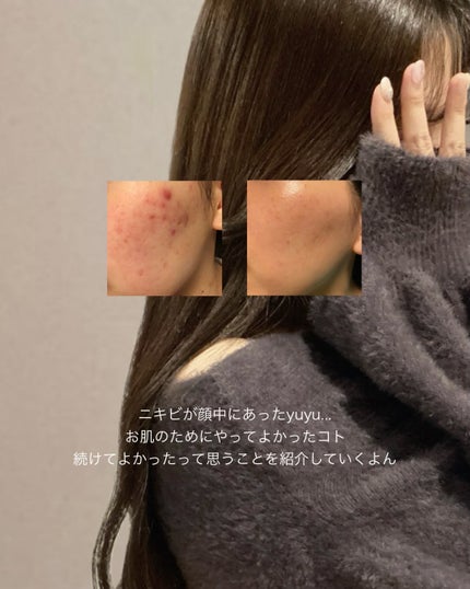 マルチファンデパフ 2P/ロージーローザ/パフ・スポンジを使ったクチコミ(2枚目)